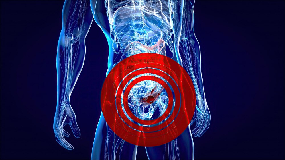 Abstract illustration of the colon cancer